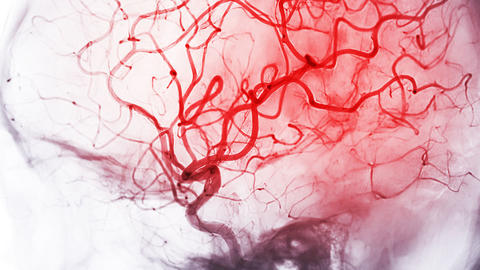 blood vessels in the brain